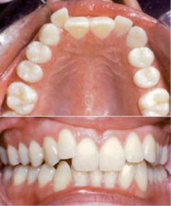 Orthodontics before